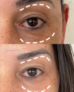 Snapinsta.app_274337141_4669700569825017_2546438553942917038_n_1080