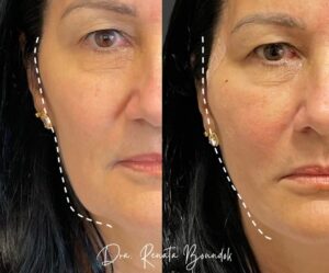 Snapinsta.app_275391238_381528176741497_4694245887024790060_n_1080