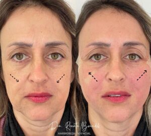 Snapinsta.app_308009644_2133110326871826_495094228959714982_n_1080