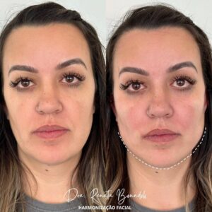 Snapinsta.app_315005508_1511977429288842_5439125316938454584_n_1080