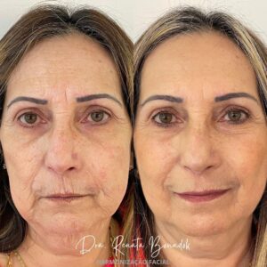 Snapinsta.app_316160277_171261288920470_7089285200080235587_n_1080