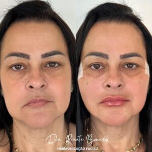 Snapinsta.app_318482522_883739659321634_1223628726544857858_n_1080