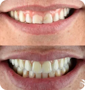 Group-17-copy-5-286x300