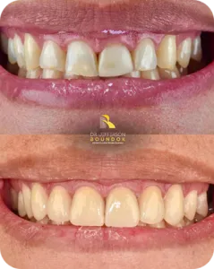 Group-18-copy-239x300