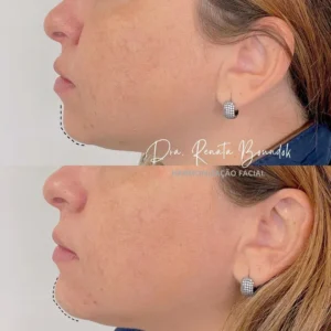 Snapinsta.app_294395239_164274606131704_9000906111331586777_n_1080