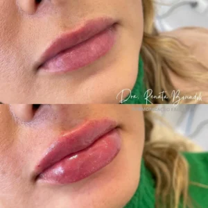 Snapinsta.app_298651808_181680111000618_3680928933653193934_n_1080